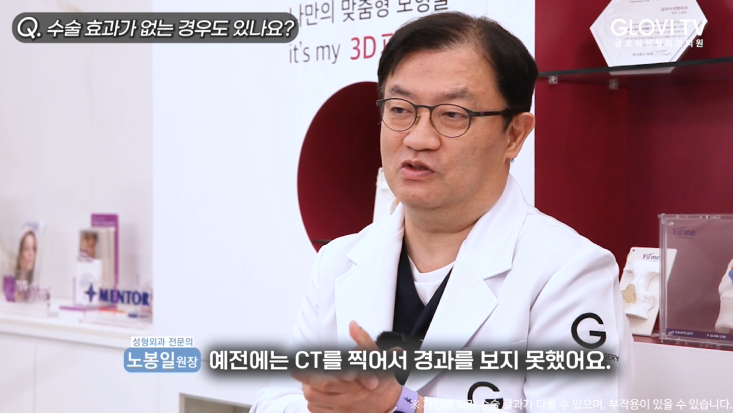 코성형 절골술, 재발률을 낮춘 새로운 방법 | 인터뷰 (1탄) 관련 이미지 22