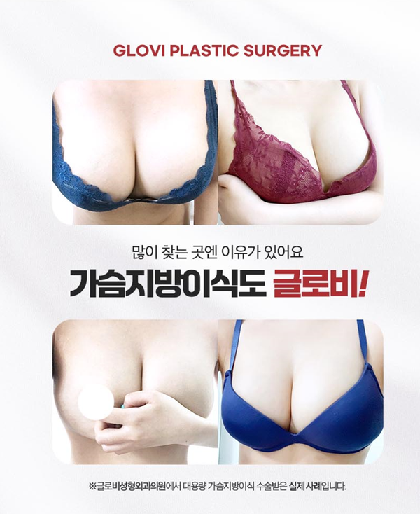 가슴보형물 제거 후 재수술? 가슴지방이식 재건으로 해결 관련 이미지 2