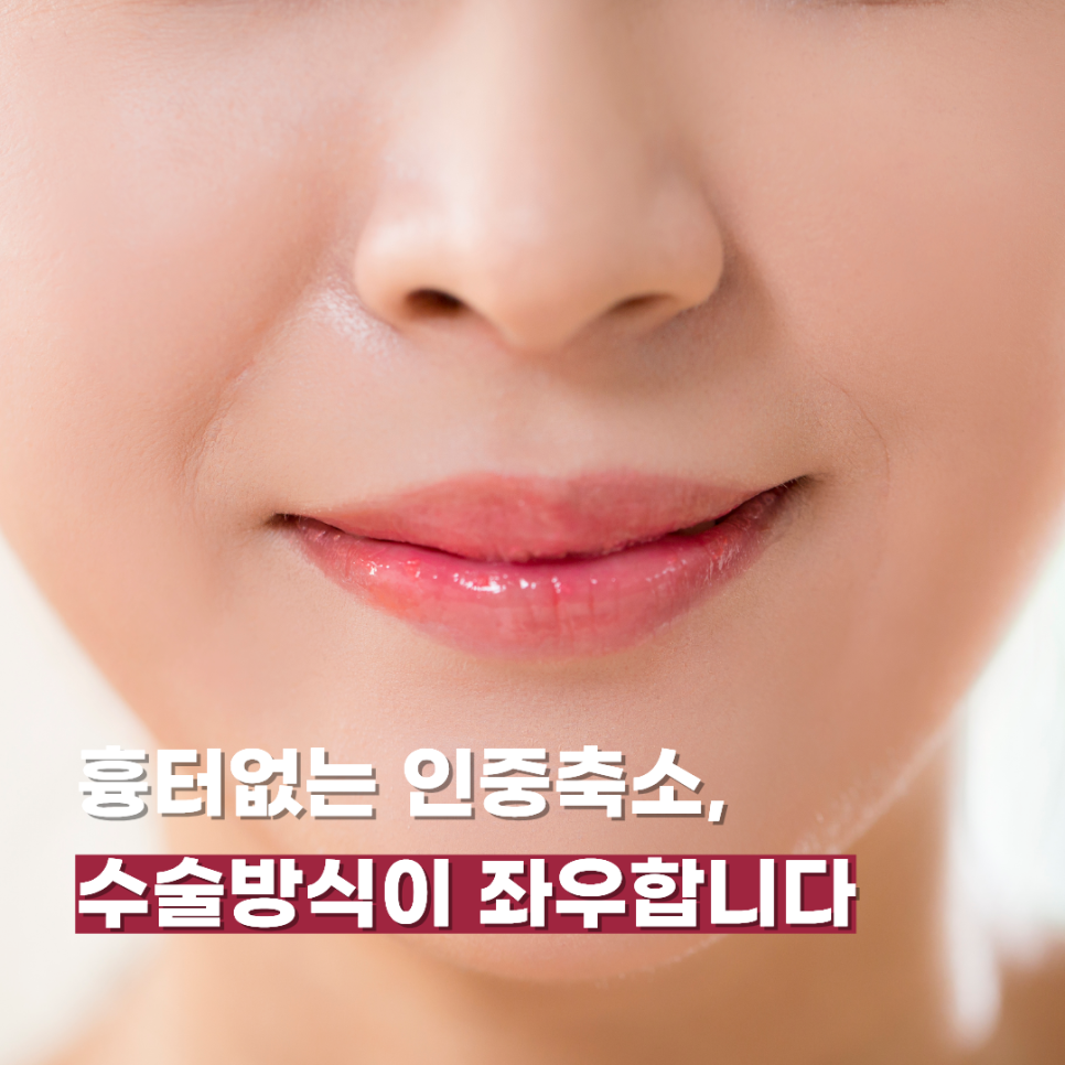 흉터없는 인중축소, 수술방식이 좌우합니다 관련 이미지 1