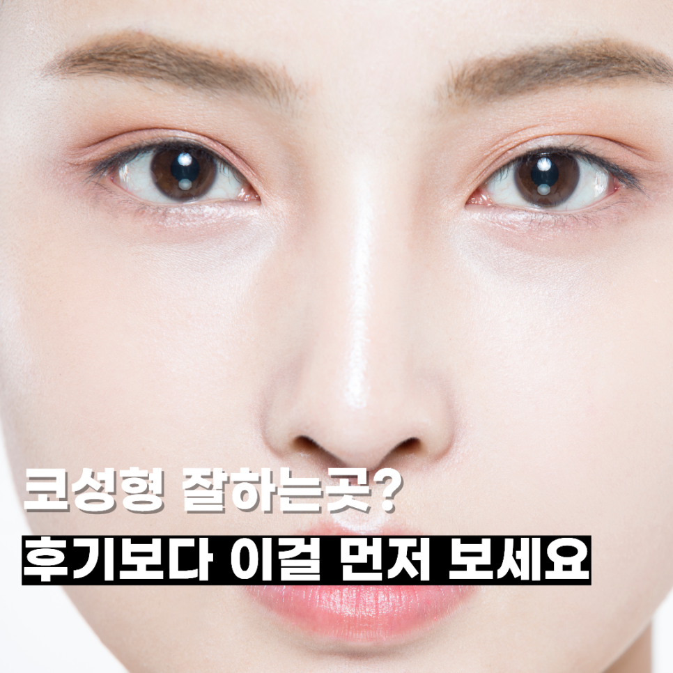 코성형 잘하는곳? 후기보다 이걸 먼저 보세요 관련 이미지 1