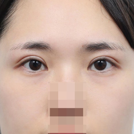 How to Choose a Clinic Specializing in Revision Eye Surgery image 8