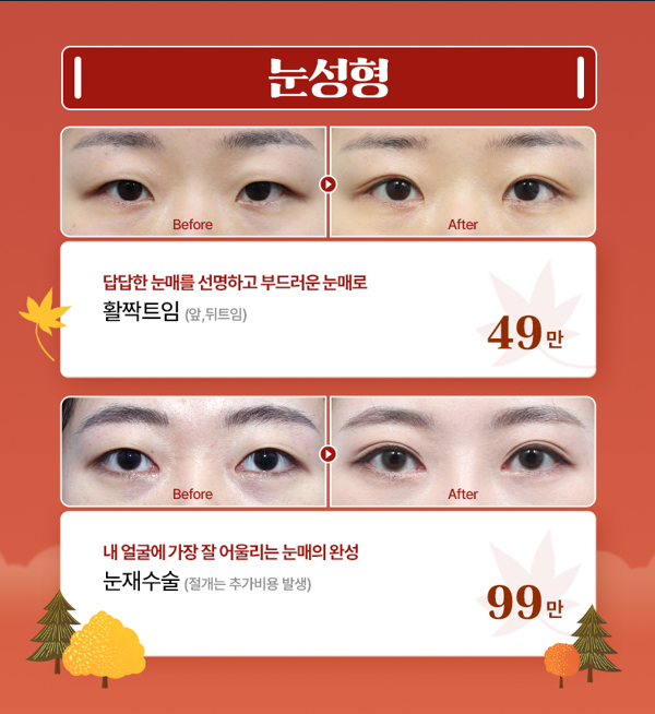 [글로비성형외과] 단풍에 물드는 10월, 가을에 반하다 Fall in Beauty 이벤트 총정리 관련 이미지 2