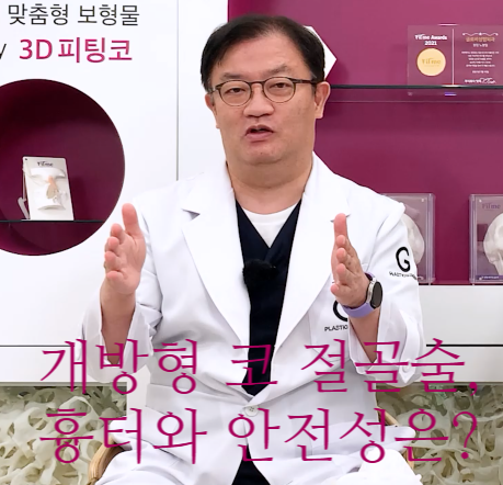개방형 코 절골술, 흉터와 안전성은? 인터뷰 (3탄) 관련 이미지 1