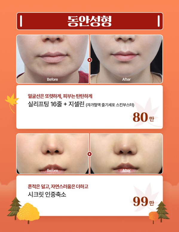 [글로비성형외과] 단풍에 물드는 10월, 가을에 반하다 Fall in Beauty 이벤트 총정리 관련 이미지 5