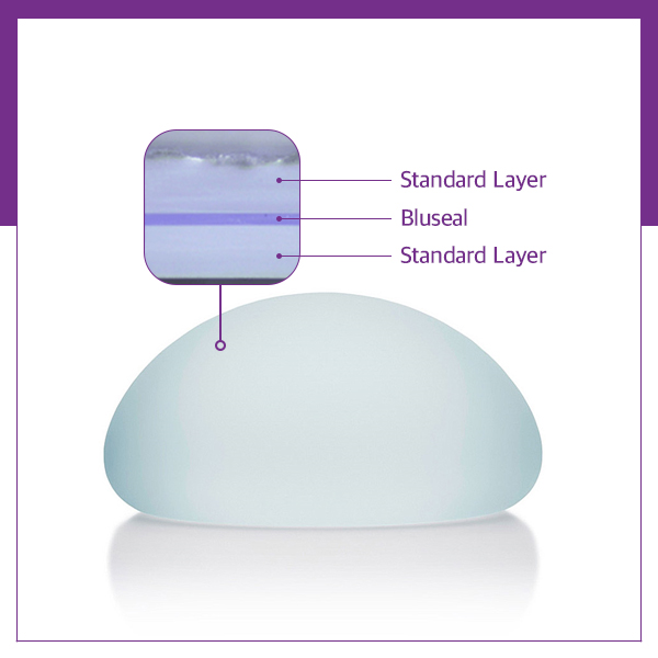 모티바가슴성형 보형물에 대해 알아보자 관련 이미지 6