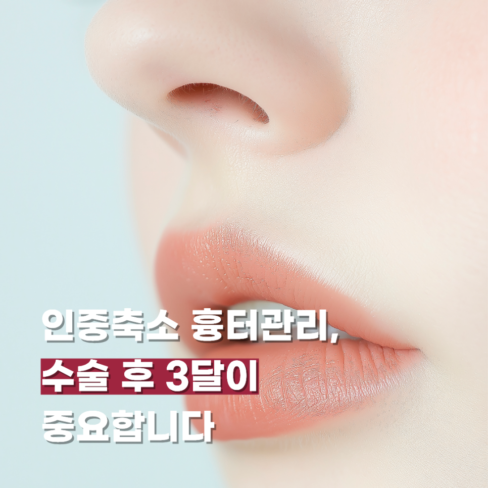 Philtrum Reduction Scar Care: The 3 Months After Surgery Are Important image 1