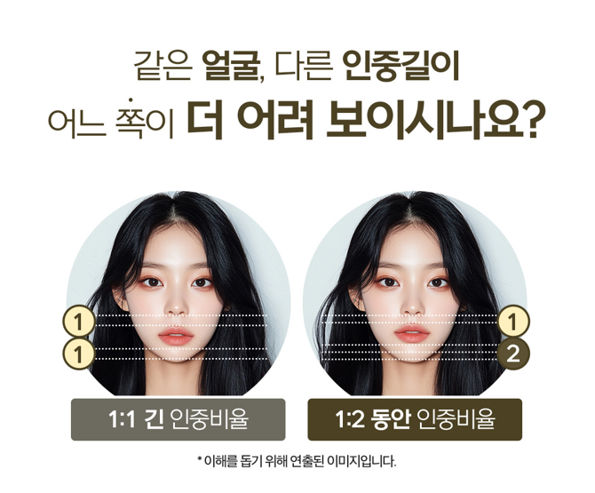 인중축소 잘하는곳, 입술이 어색해지는 부작용을 낮추는 수술법 관련 이미지 9