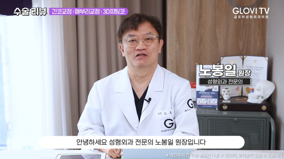 매부리코 긴코 코성형 리뷰, 글로비 3D 피팅코수술 관련 이미지 1
