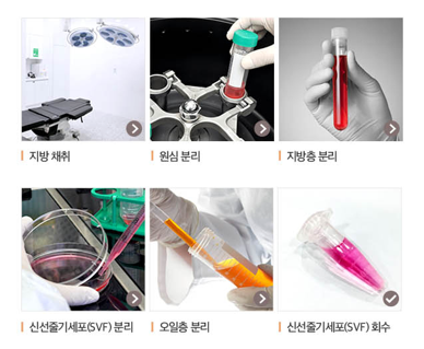 가슴 지방이식, 넣는 것보다 살아남는 것이 중요합니다 관련 이미지 5