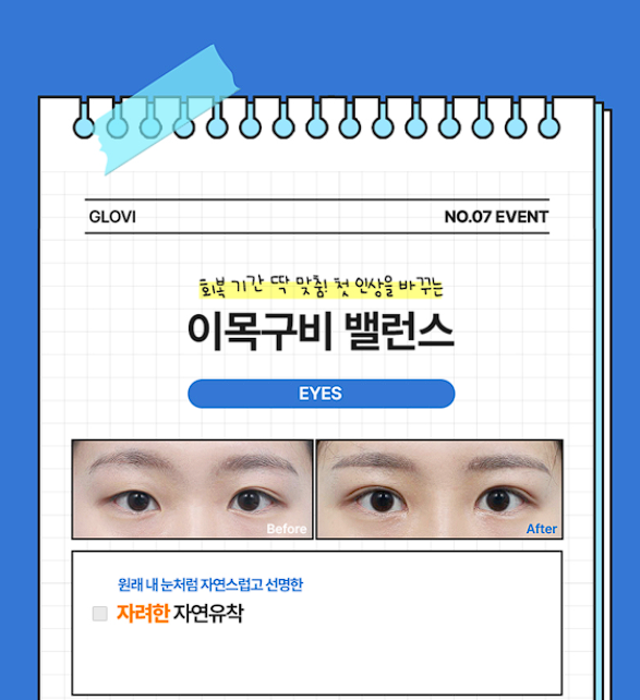 [글로비성형외과] 여름방학 이벤트! 눈&middot;코&middot;바디 라인 혜택 정리 관련 이미지 2