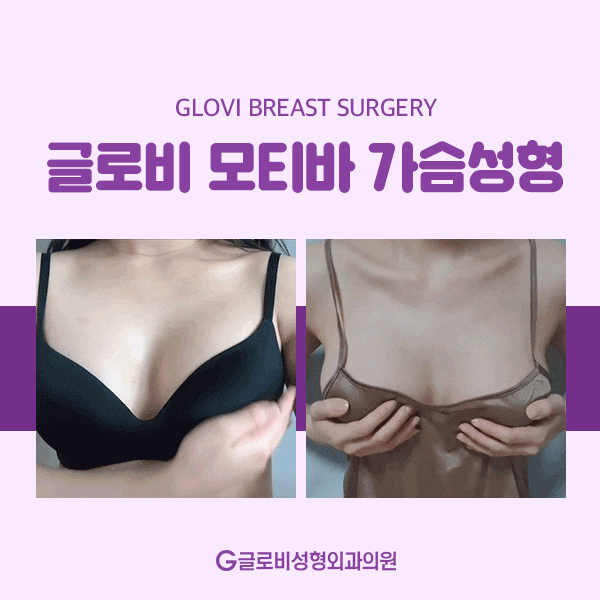 모티바가슴성형 보형물에 대해 알아보자 관련 이미지 4
