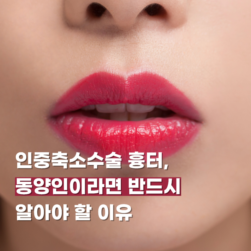 Why Scars from Philtrum Reduction Surgery Are Something East Asians Must Know About image 1