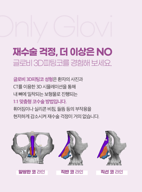 The Cost of Rhinoplasty for Women: A Smart Choice Between Safety and Price image 5