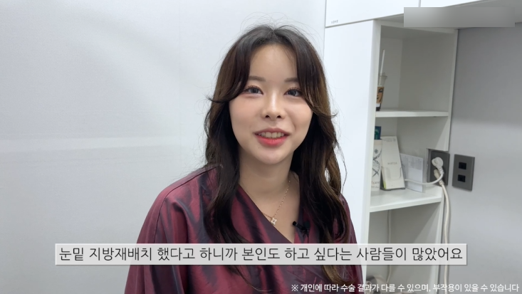 눈밑지방재배치수술 리얼후기 2탄｜수술 한달 후 경과확인! 관련 이미지 5