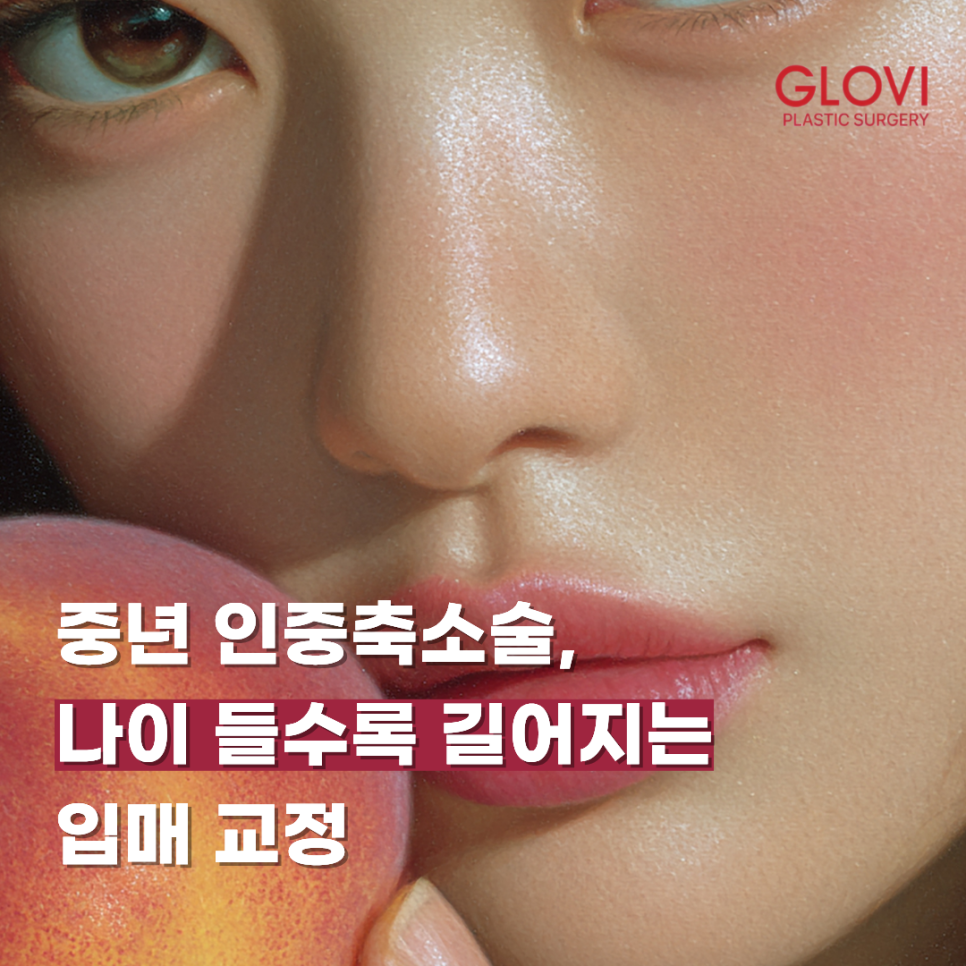 Philtrum Reduction for Middle-Aged Patients: Correcting the Lengthening Area Between the Nose and Upper Lip with Age image 1