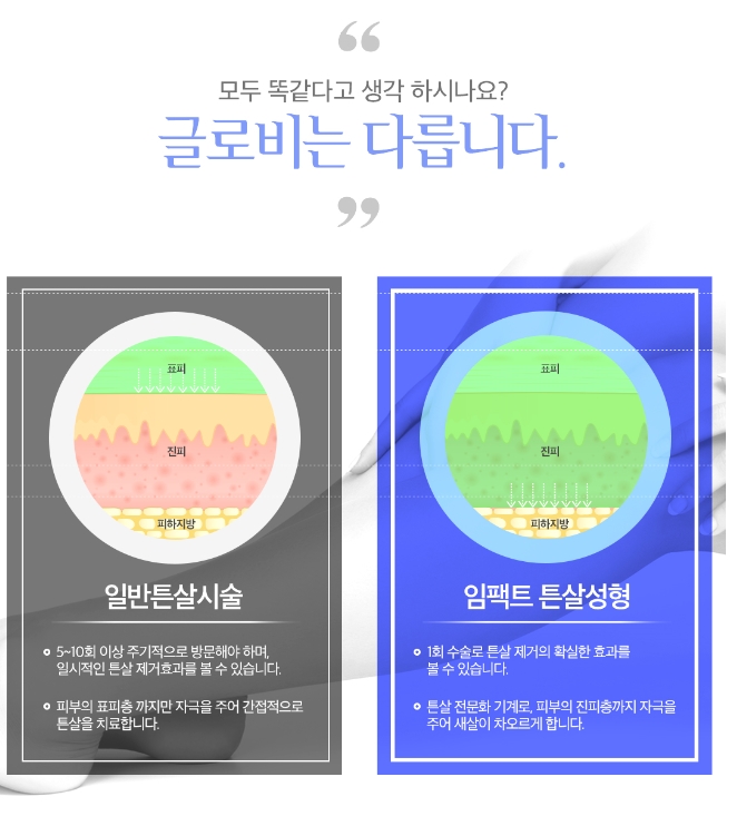 튼살치료 망설이지 마세요! 관련 이미지 2