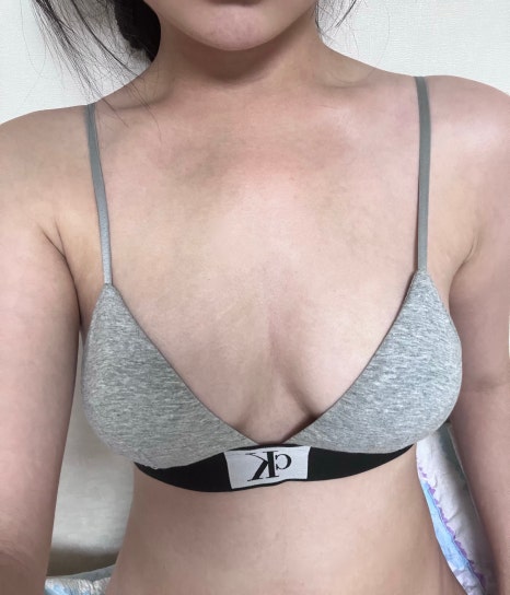 가슴지방이식 지방흡입 같이 하면 어떤 점이 달라질까요 관련 이미지 5