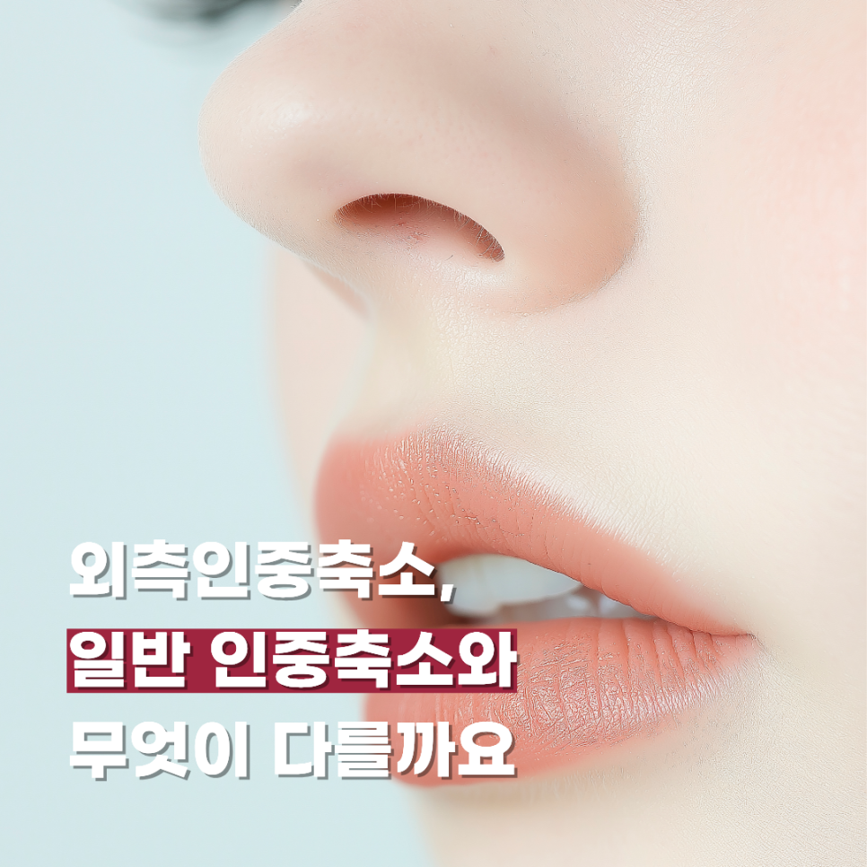 외측인중축소, 일반 인중축소와 무엇이 다를까요 관련 이미지 1