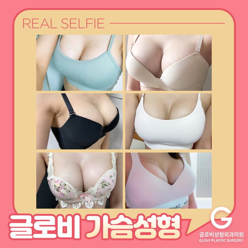 가슴지방이식후기, 줄기세포가 들어가면 효과가 좋을까? 관련 이미지 1