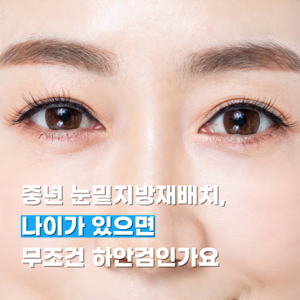 중년 눈밑지방재배치, 나이가 있으면 무조건 하안검인가요 관련 이미지 1