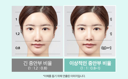 코성형 긴코, 어떻게 줄이고 자연스럽게 만들까? 관련 이미지 4