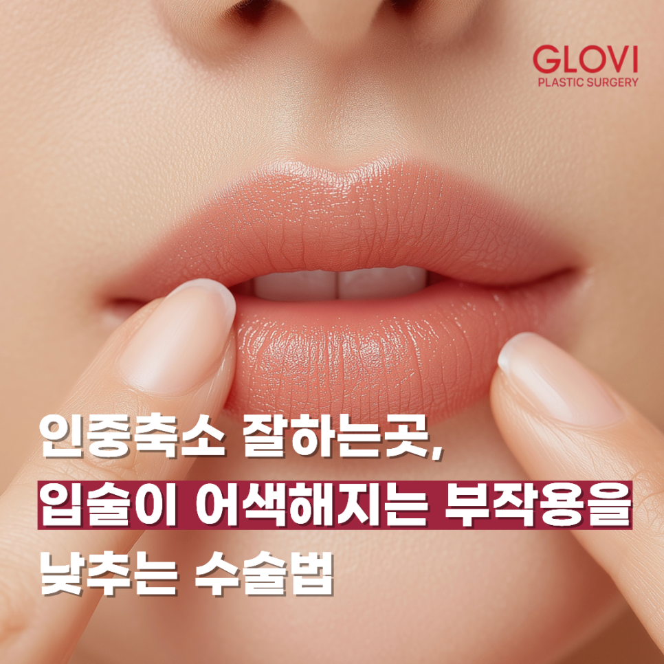 인중축소 잘하는곳, 입술이 어색해지는 부작용을 낮추는 수술법 관련 이미지 1