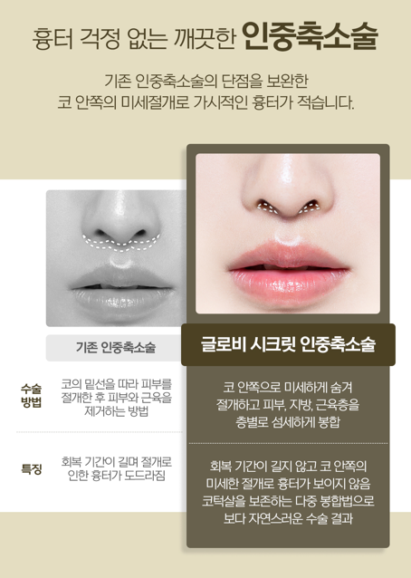 인중축소술 전후, &lsquo;이것&rsquo;은 알고 받아야합니다 관련 이미지 2