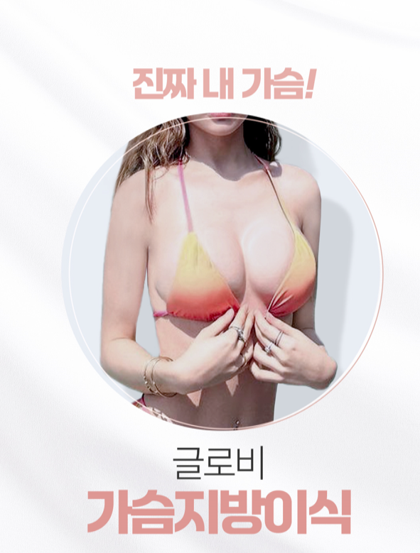 강남가슴성형, 지방이식전 알아둬야할 체크리스트 관련 이미지 2