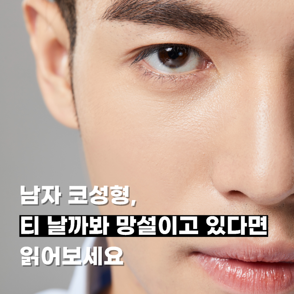 남자 코성형, 티 날까봐 망설이고 있다면 읽어보세요 관련 이미지 1