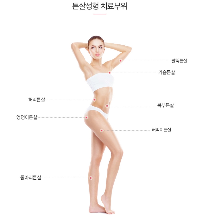 튼살치료 망설이지 마세요! 관련 이미지 3