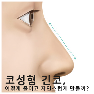 코성형 긴코, 어떻게 줄이고 자연스럽게 만들까? 관련 이미지 1