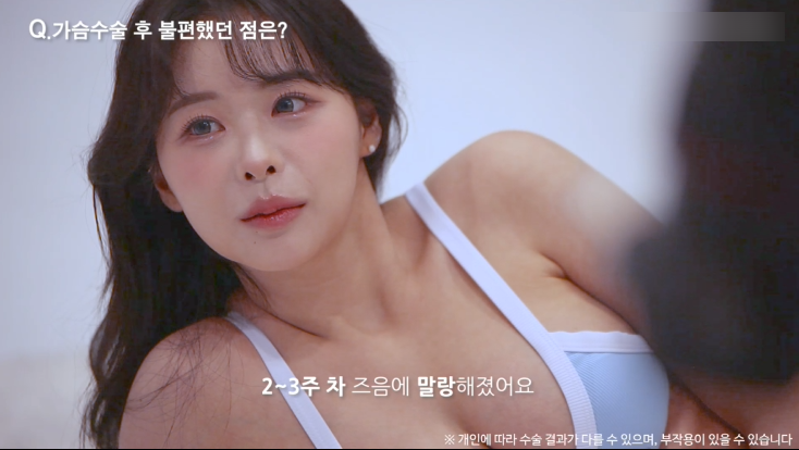 모티바가슴성형 리얼후기 2탄｜글로비성형외과의원 관련 이미지 27