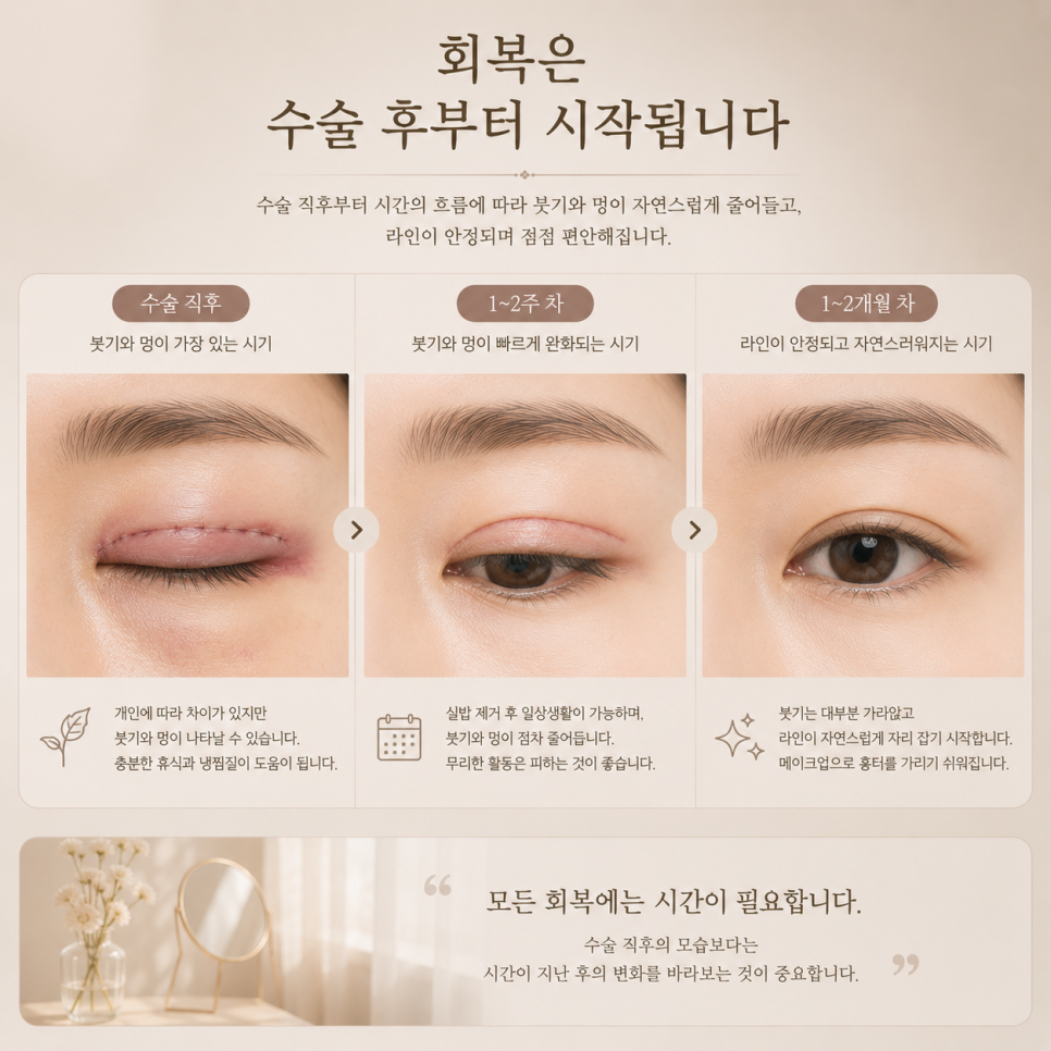 How Can Drooping Upper Eyelids Be Improved in Middle Age? image 5