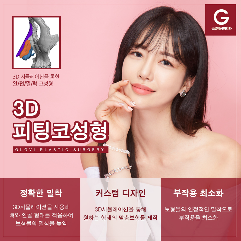 코성형유명한병원 3D피팅코 관련 이미지 2