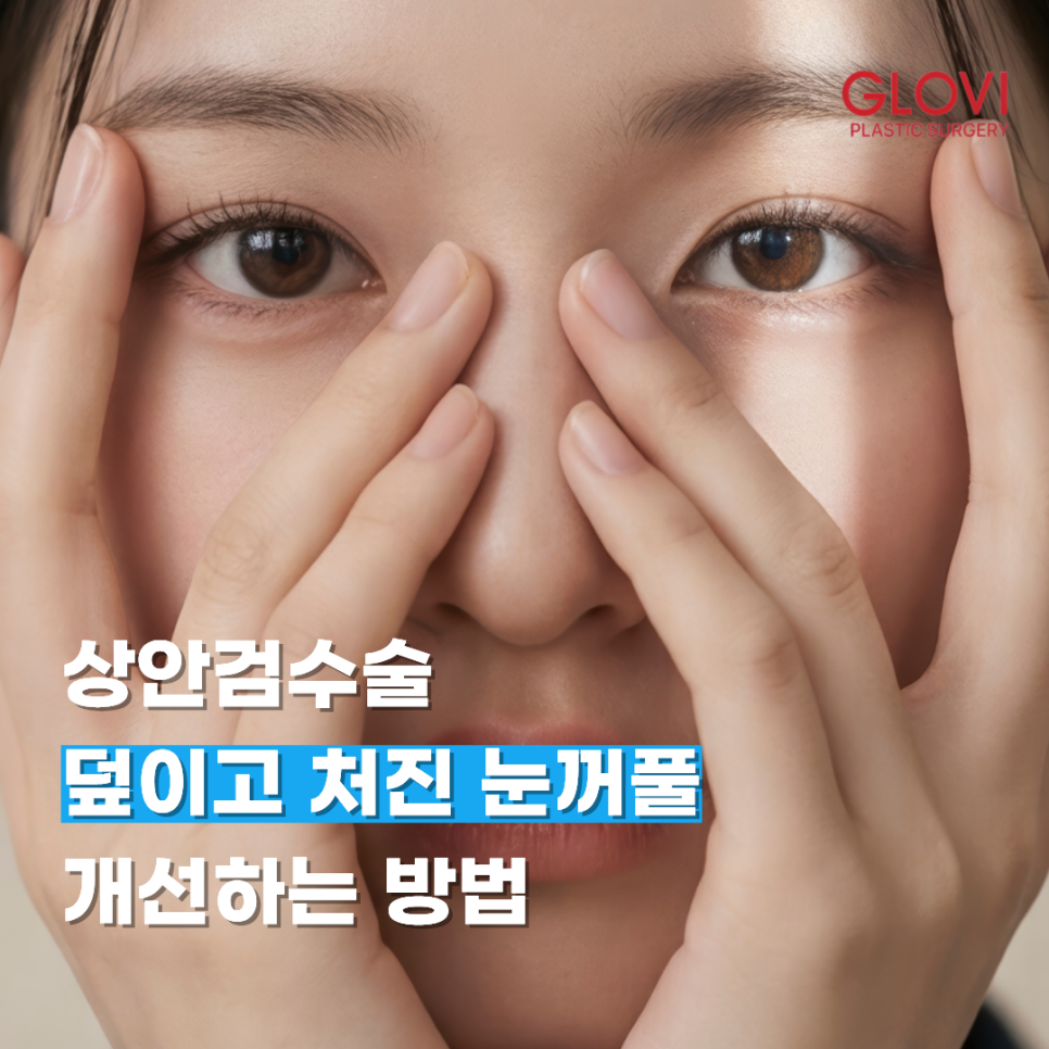 Upper Blepharoplasty: How to Improve Covered, Drooping Eyelids image 1