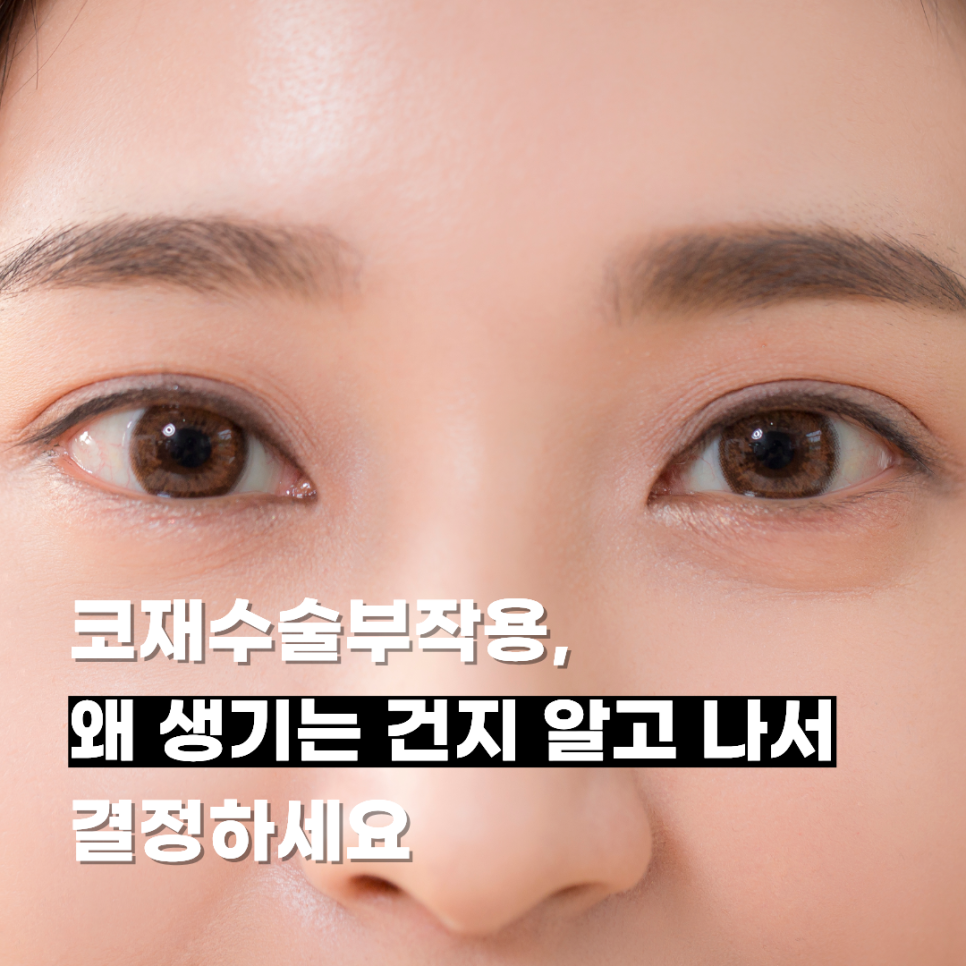 코재수술부작용, 왜 생기는 건지 알고 나서 결정하세요 관련 이미지 1