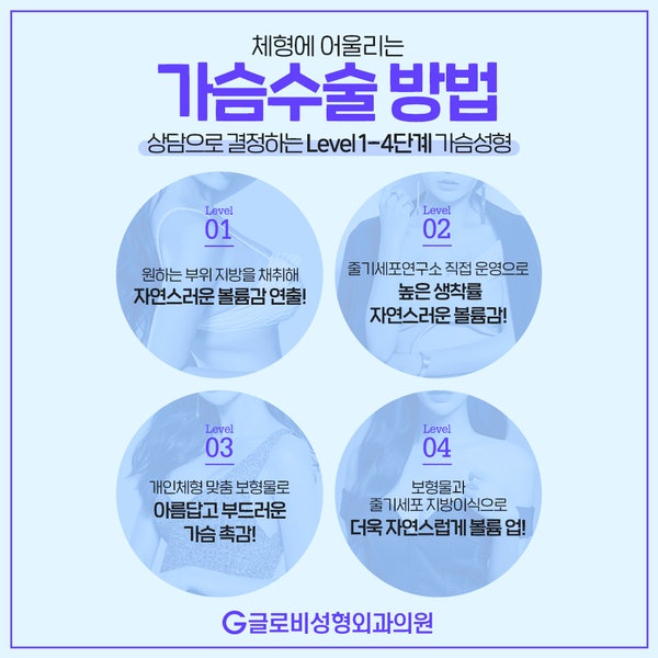 가슴성형비용, 모티바 멘토 세빈 어떻게 다를까 관련 이미지 3