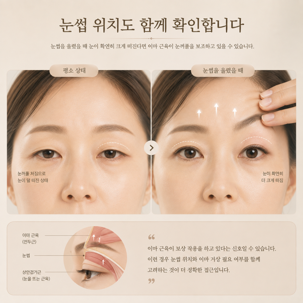 How Can Drooping Upper Eyelids Be Improved in Middle Age? image 4