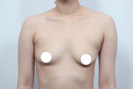 Pain After Breast Surgery May Be a Warning Sign Your Body Should Not Ignore image 2