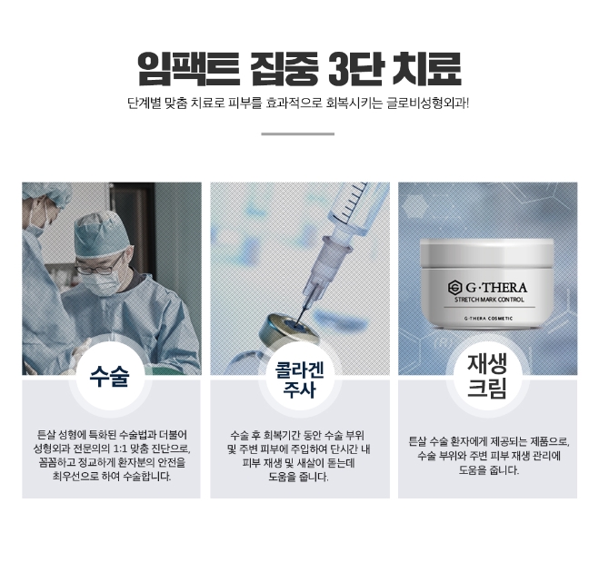 튼살치료 임팩트튼살성형으로! 관련 이미지 4