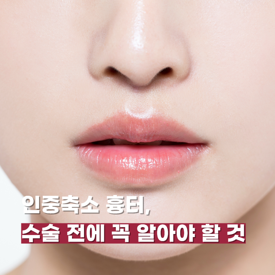 인중축소 흉터, 수술 전에 꼭 알아야 할 것 관련 이미지 1