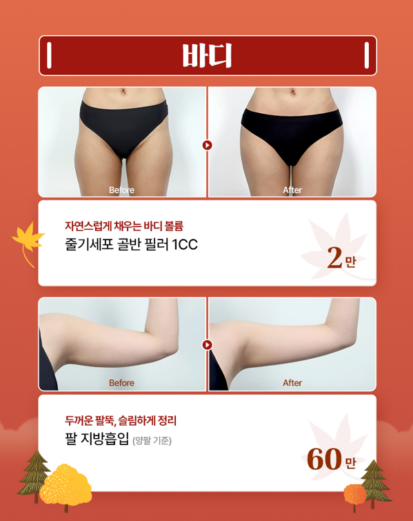 [글로비성형외과] 단풍에 물드는 10월, 가을에 반하다 Fall in Beauty 이벤트 총정리 관련 이미지 6
