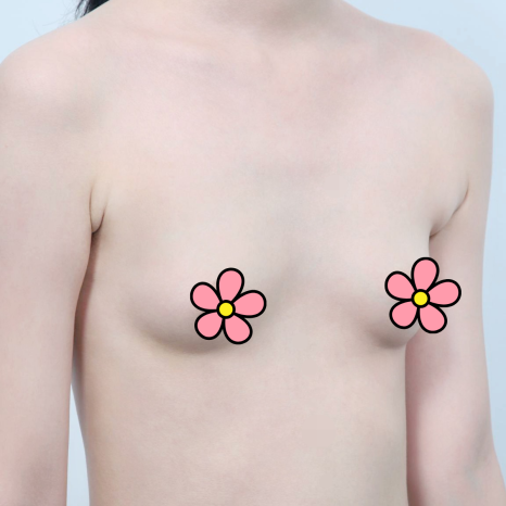 Breast Fat Grafting Review: Everything from Consultation to Recovery image 7