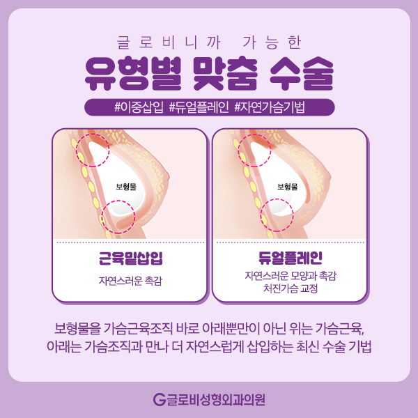 모티바가슴성형 보형물에 대해 알아보자 관련 이미지 8