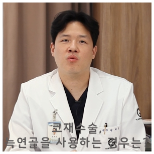 코재수술, 늑연골을 사용하는 경우는? 관련 이미지 1