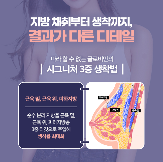 가슴지방이식가격 형성 기준과 상담 시 확인해야 할 점 관련 이미지 5