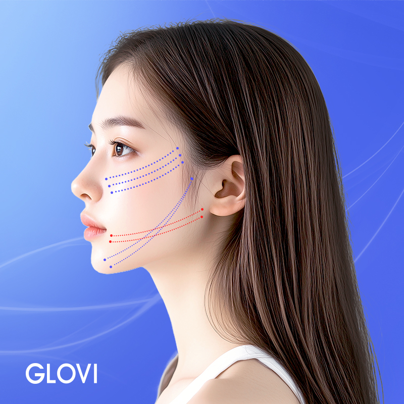 실리프팅 효과와 유지기간, 처짐 개선에 얼마나 도움 될까? 관련 이미지 2