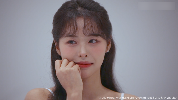 눈밑지방재배치수술 리얼후기 2탄｜수술 한달 후 경과확인! 관련 이미지 12