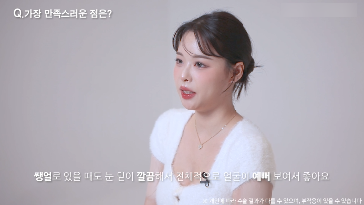 눈밑지방재배치수술 리얼후기 2탄｜수술 한달 후 경과확인! 관련 이미지 10