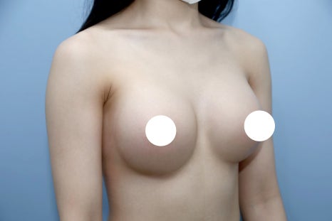 가슴성형잘하는곳, 기술보다 먼저 확인해야 할 기준이 있습니다 관련 이미지 5